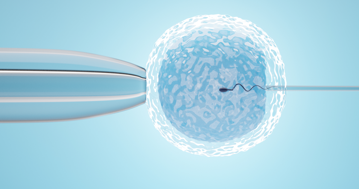 Intracytoplasmic Sperm Injection (ICSI) Treatment in Anna Nagar, Chennai