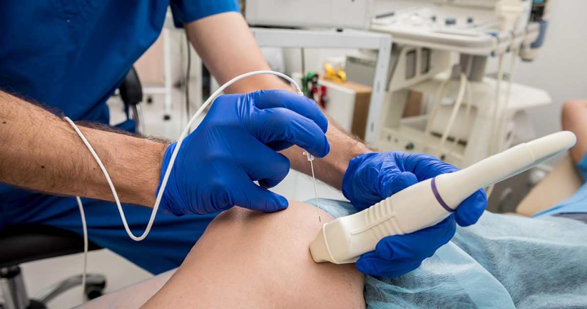 microwave ablation treatment in anna nagar